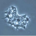 Acanthamoeba