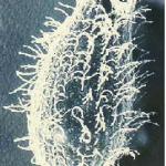 Balantidium