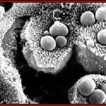 Cryptosporidium
