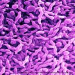 Gastroenterit