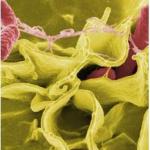 Salmonella